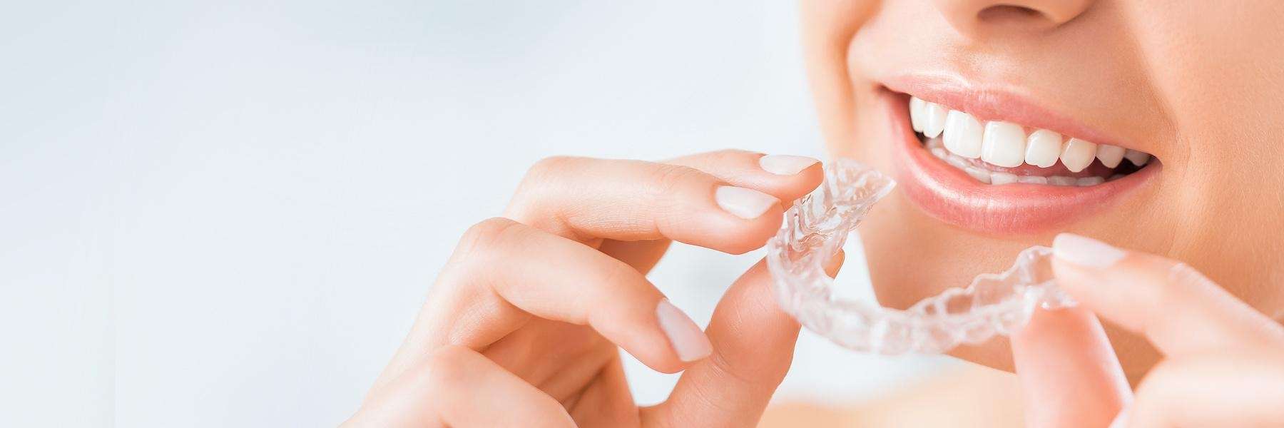SureSmile Aligners in Champaign IL