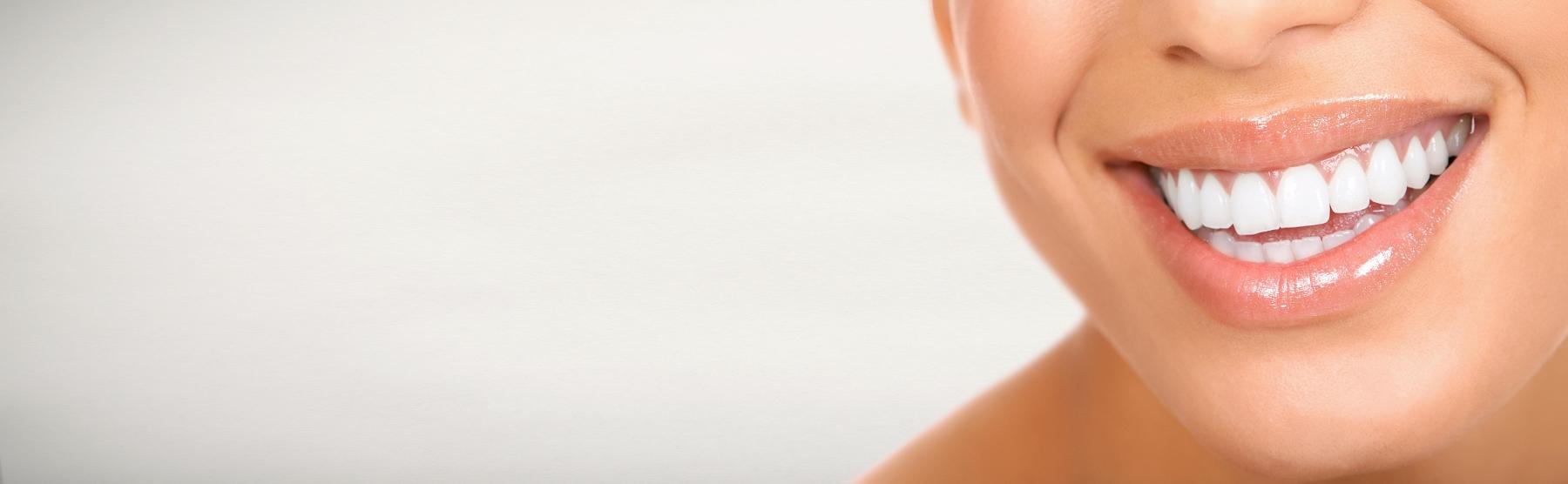 Close up of woman smiling at cosmetic dentist near me Champaign, IL