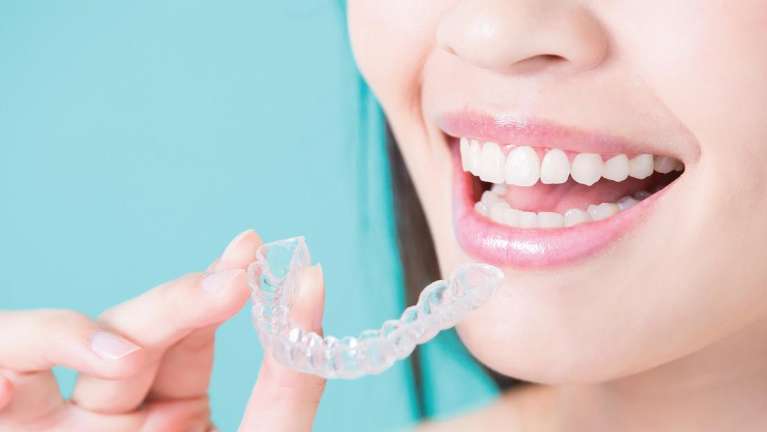 Woman holding SureSmile Aligners