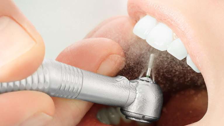 dental filling champaign il